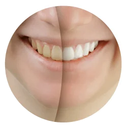 Cosmetic Dentist in QLD
